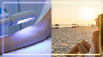 Uv Exposure Artificial Intensity Vs Natural Sun